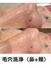【毛穴の黒ずみ・詰まり改善】毛穴洗浄（鼻＋頬）初回体験¥5,500