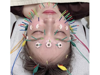 メディカルジャパン 国分寺/美容鍼