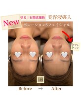 フォルチェ 春日(Folche)/メンズフェイシャル☆