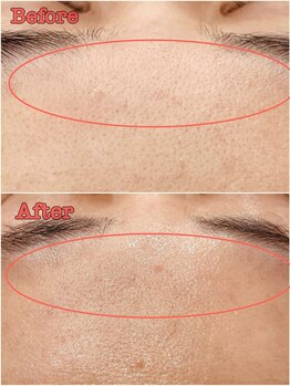 プチ プロムナード(Petit Promenade)/美肌フェイスワックス