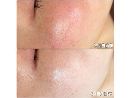 ジン フォー ユアビューティー(JIN for your beauty)の写真