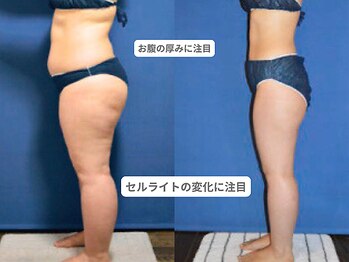 アンシャンテ 神戸元町店(Enchante)/痩身ダイエット　神戸元町三ノ宮