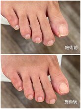 レフス 北参道店(REFUSS)/爪カッティング