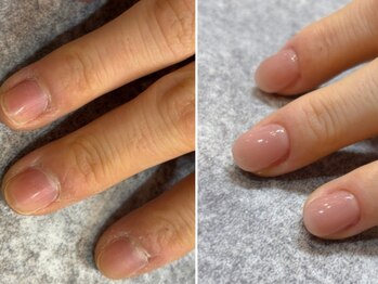 ココネイル(coco.nail)の写真/自爪のトラブルを解消したい方に。状態にあわせてしっかりケア。派手なネイルができない方にもおすすめ◎