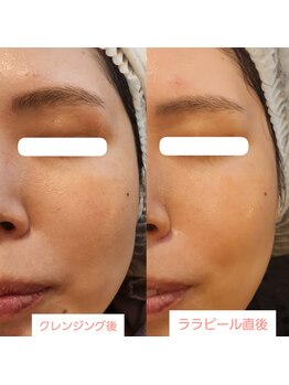 ビューティールームウィズ(beauty room w/)/ 肌を満たし艶肌水光肌へ