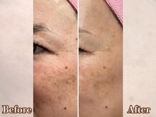 エクラ(eclat)/セルマン