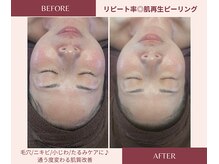 プレジール(Plaisir)の雰囲気（毛穴ケアもお任せ下さい。赤ら顔/ザラつき/ツヤ肌/フェイシャル）
