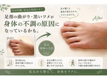 サロンラグナ(Salon Laguna)の写真/足の指の曲がり・黒い爪、放置してない？不調の原因かも。身体の土台から整えるフットケア
