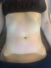 ビテ(Bite)/【くびれ腹】20代　会社員