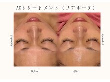 サロンドエー 帝塚山(Salon de A)/鏡見てテンション上がらなければ