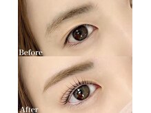 レピア 高槻店/韓国式LEPIA Before&After