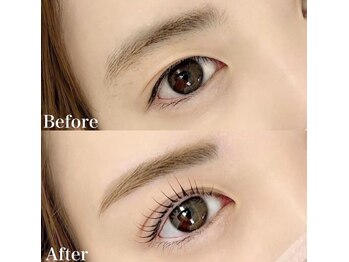 レピア 高槻店/韓国式LEPIA Before&After