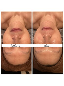 ソーレ(Sole)/芸能人御用達!