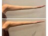 【二の腕☆引き締め】気になる二の腕のたるみや脂肪を引き締め理想の姿へ☆