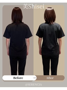 セレンシア(SERENCIA)/たった一回でもこの効果☆