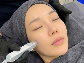 オリオンドットエスツー(Orion.S2)の写真/元看護師が施術♪40種以上の美容液で毛穴汚れを徹底除去◎【ハイドラフェイシャル毛穴洗浄初回￥5980】