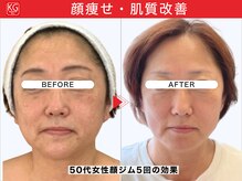顔ジム 麻布店/50代女性顔ジム継続の効果