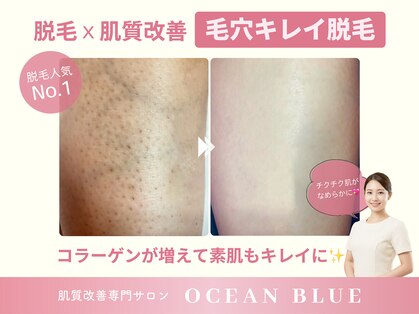オーシャンブルー 長崎店(OCEAN BLUE)の写真