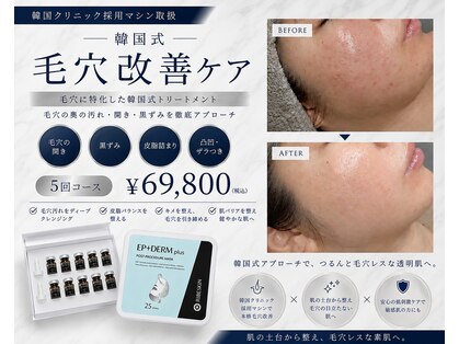 リュノン(Lunon.)の写真
