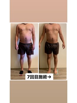 ハジチ(HAZICHI)/寝たまま筋トレ!大人気の痩身!