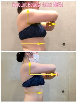 エクセレントビューティーサロン 艶(EN)/ブライダル７回
