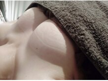 ビテュセ(美Tu sais)/バストアップ症例【バストケア】