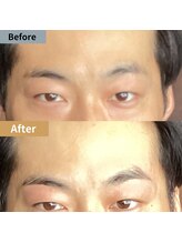 眉毛ハウス 吉祥寺店(眉毛HOUSE)/お客様の施術例(吉祥寺/東京)