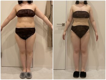 ビビ センター北店(Bibi)/ビフォーアフター