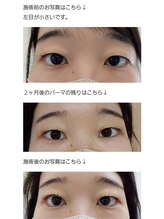 アロマスイーツ(AromaSweets)/まつげパーマ/マツパ/パーマ