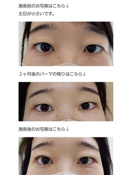 アロマスイーツ(AromaSweets)/まつげパーマ/マツパ/パーマ