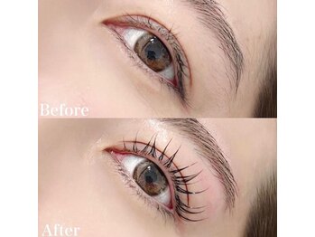 レピア 高槻店/韓国式LEPIA Before&After