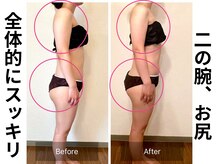 ヨサパーク ルアナ 高島店(YOSA PARK Luana)/二の腕おしり、全体的にスッキリ