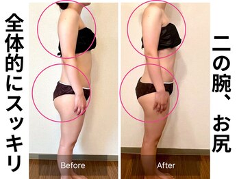 ヨサパーク ルアナ 高島店(YOSA PARK Luana)/二の腕とおしりって落ちないよね