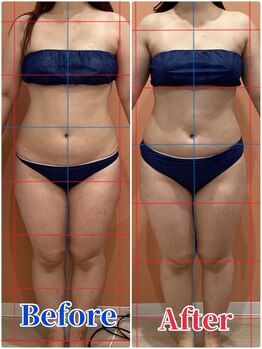 ハンズ鍼灸接骨院江南院 美容整体ハンズ(美容整体hands)/痩身エステ施術のお客様