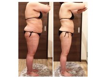 エステサロン ベリシモ(Bellissimo)/痩身/ビフォーアフター