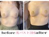 【業界トップレベル☆】光バスト30分/￥9900