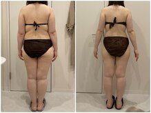 ビビ センター北店(Bibi)/ビフォーアフター