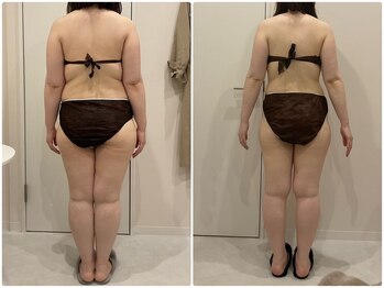 ビビ センター北店(Bibi)/ビフォーアフター