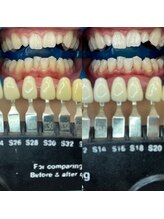 トウキョウスワーズ 池袋店(TOKYO SWRS)/#ホワイトニング #池袋 #渋谷