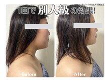 ルリアン(Lurian)/1回60分のBefore→After