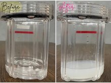 エステティックサロン ベルエトワール住吉店/ハイドロヴィーナス