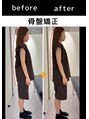 エレヴィザ トウキョウ 恵比寿院(ELVISA TOKYO) 姿勢改善整体/骨盤矯正/恵比寿/東京/渋谷/広尾/小顔矯正