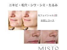 ミスト(MISTO)の雰囲気(エステ脱毛メニュー充実しております♪メンズも◎ツルスベ肌に☆)