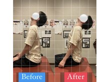 ナオル整体 宮崎院(NAORU整体)/30代男性施術事例【首こり改善】