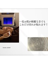 ビューティーサロンエイト(Beauty Salon8)/ハイドロで毛穴洗浄
