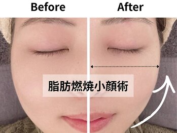 モンロー(MonroE+)