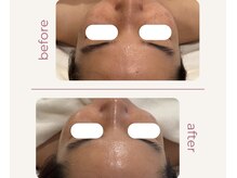 チッチ アフロディーテ(Chicchi Aphrodit)の雰囲気(美しい素肌毎日更新。肌育ケア。毛穴洗浄+ハーブピーリング5回)