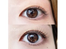 アップフォースリフト(UPforceLift)の雰囲気(【特許取得技術】アップフォースリフト★幅広くデザインをご用意)