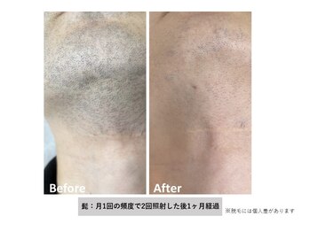 エムエスアイ(MSI)/ビフォー アフター