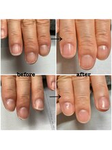 アルシエロ(al cielo)/ネイルケア